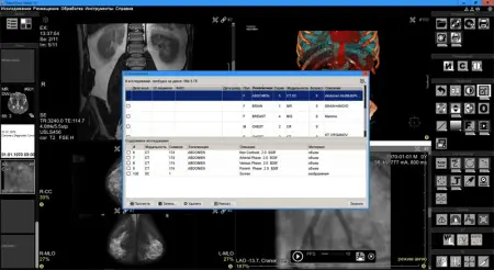 Vidar Dicom Viewer Lite