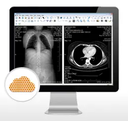 Merge eFilm Workstation