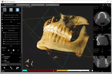 CS 3D Imaging Software